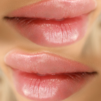 collage lips 7